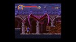 *CASTLEVANIA ADVANCE COLLECTION*XBOX ONE/X|S*КЛЮЧ*