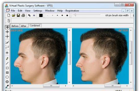 Программа виртуальной пластической хирургии