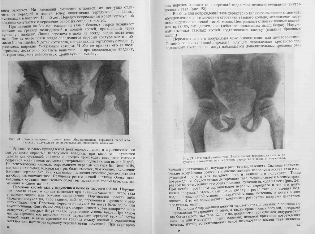 Неотложная рентгенодиагностика в неонатологии и педиатрии атлас рентгеновских изображений