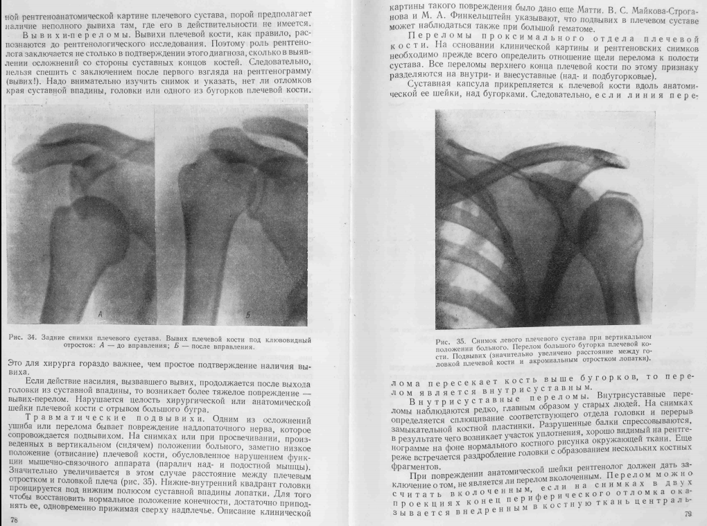 Неотложная рентгенодиагностика в неонатологии и педиатрии атлас рентгеновских изображений