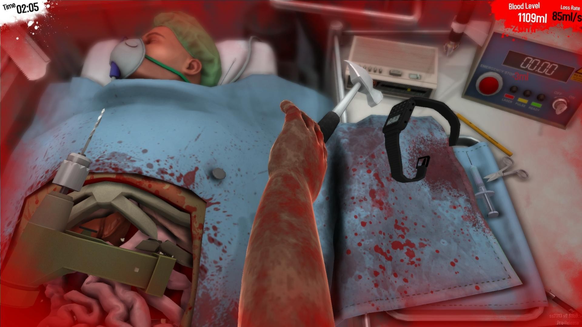 Surgeon simulator steam fix фото 80