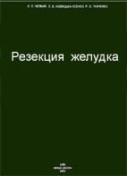 Резекция желудка Русанов А.А. 1986г.